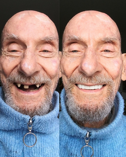 Solenadent Takma Diş